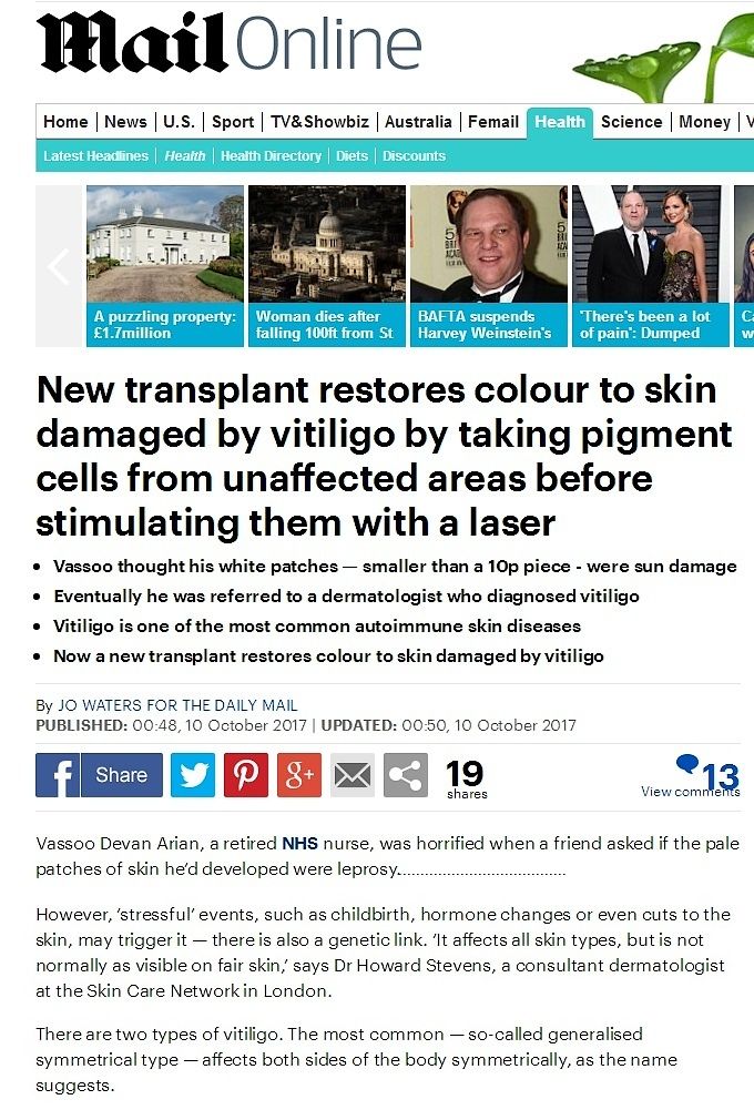 Vitiligo article in Mail health