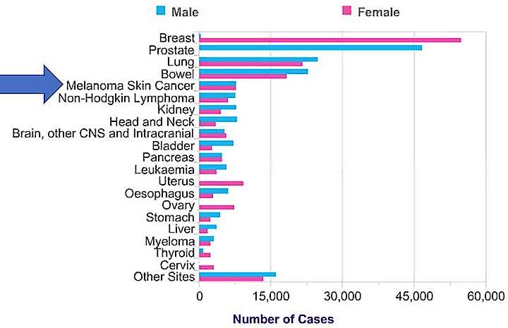 Current melanoma prevalence
