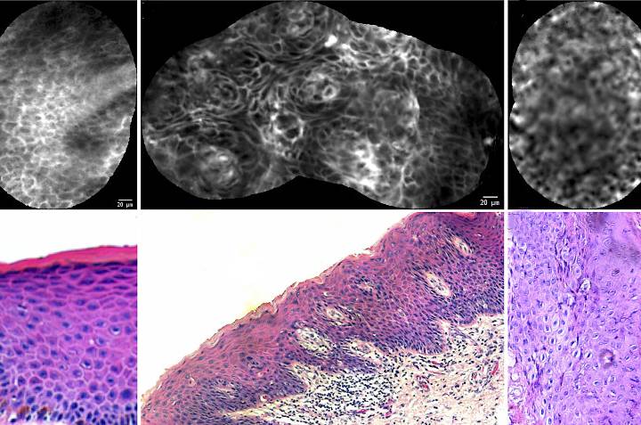 Microscopic images of penile skin cells