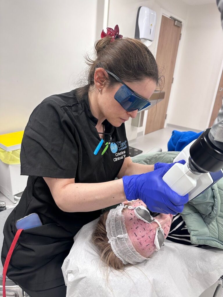 Accure Laser: Clinical Evidence and Real-World Results in Acne Treatment